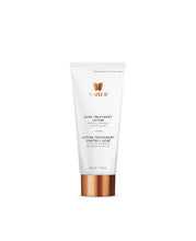 Load image into Gallery viewer, Acne Treatment Lotion